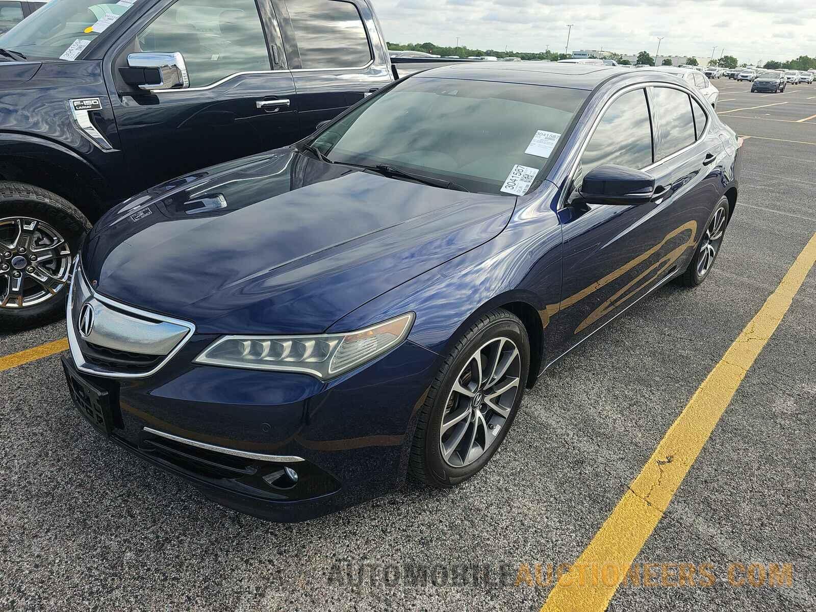 19UUB2F78HA000797 Acura TLX 2017