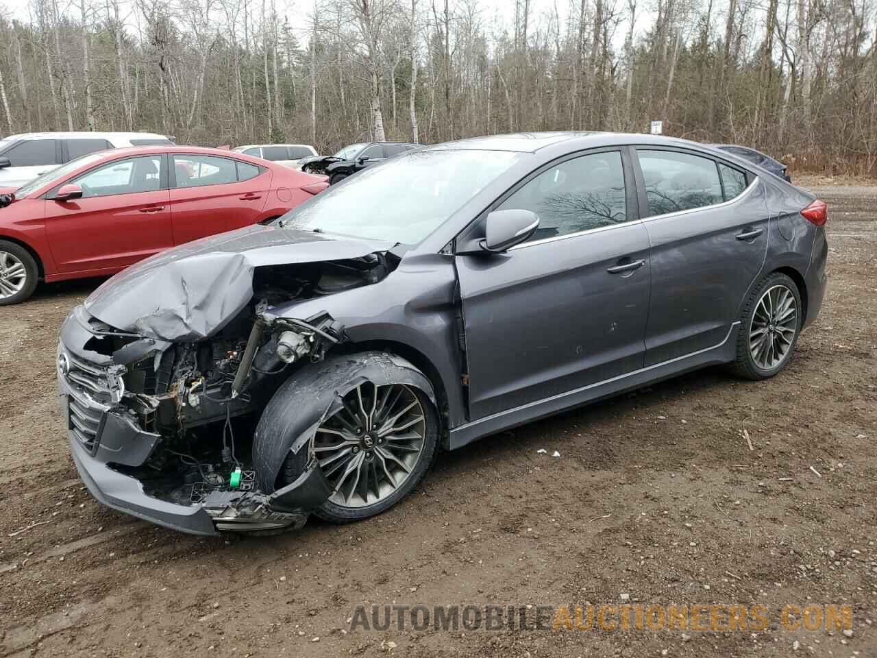 KMHD04LB0HU317489 HYUNDAI ELANTRA 2017