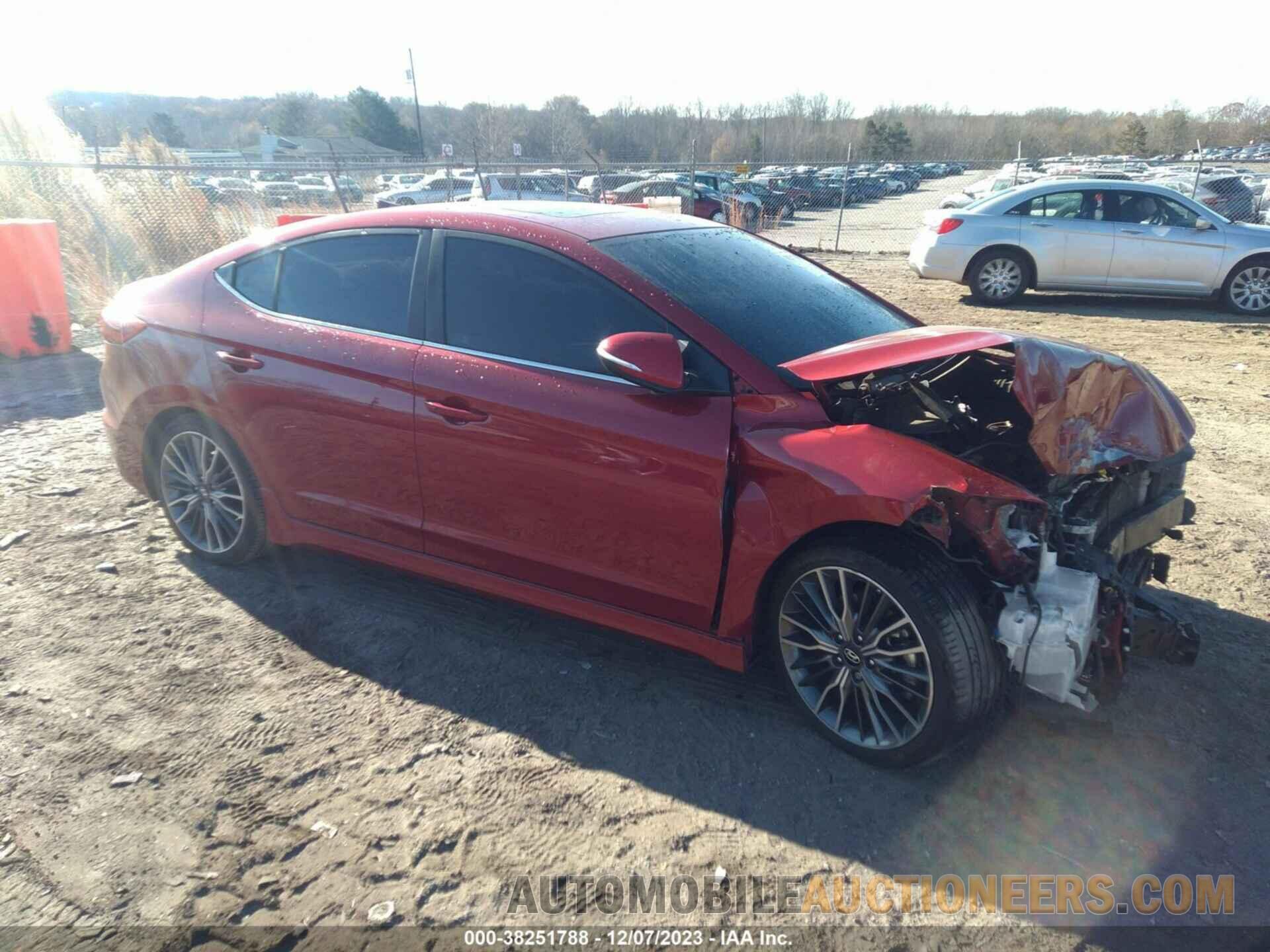 KMHD04LB0JU500591 HYUNDAI ELANTRA 2018