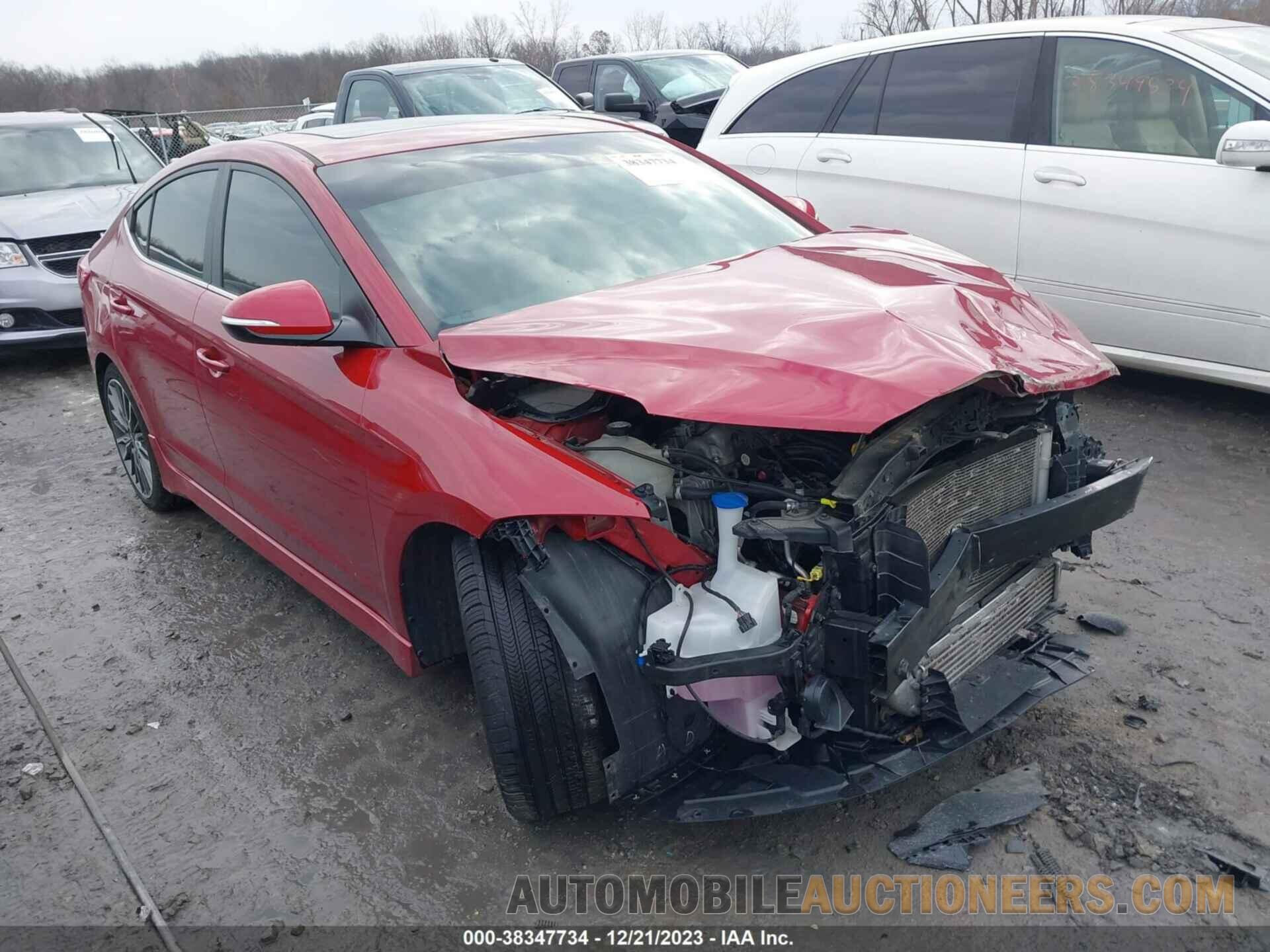 KMHD04LB1JU539853 HYUNDAI ELANTRA 2018