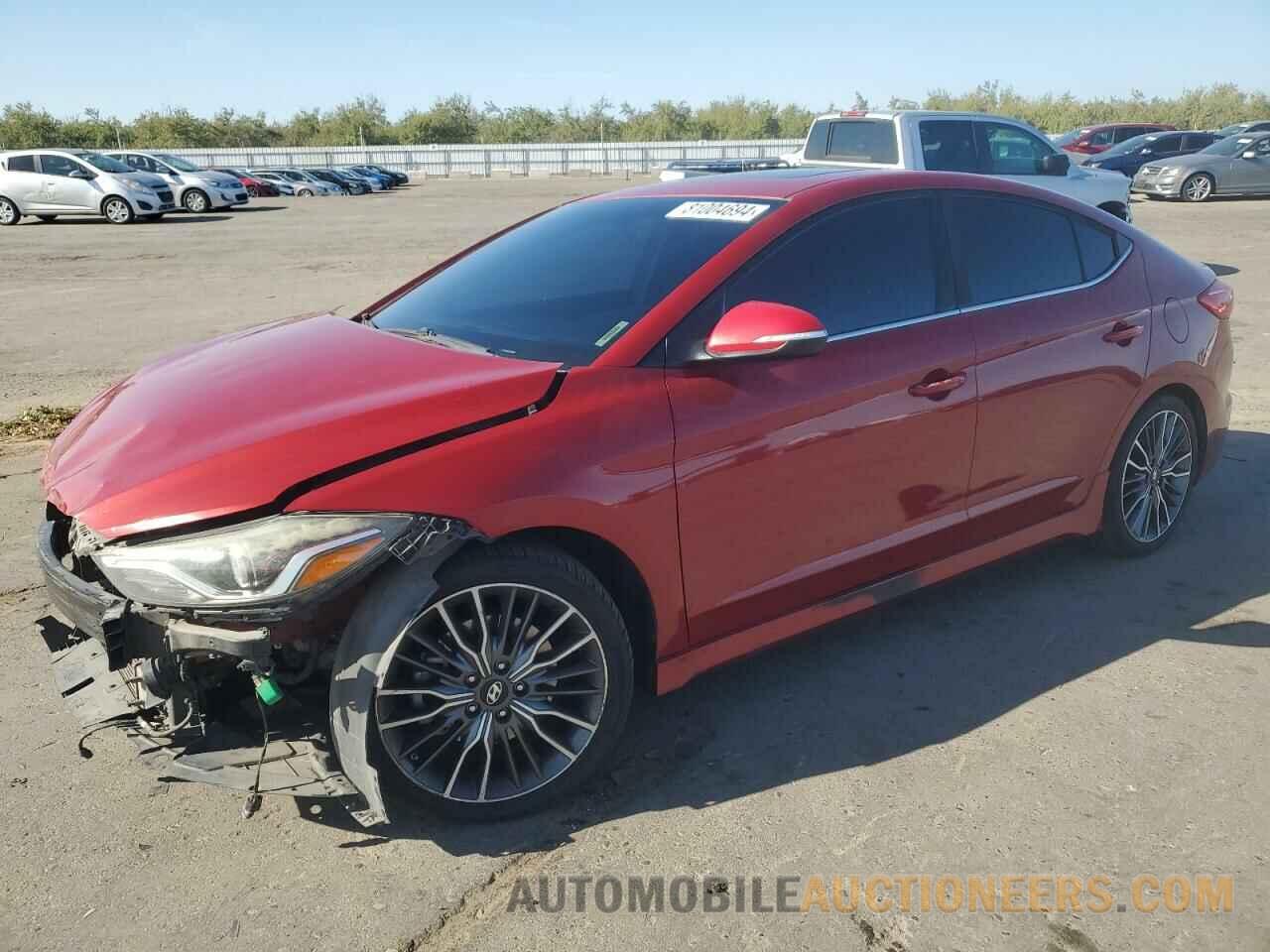 KMHD04LB2JU520082 HYUNDAI ELANTRA 2018