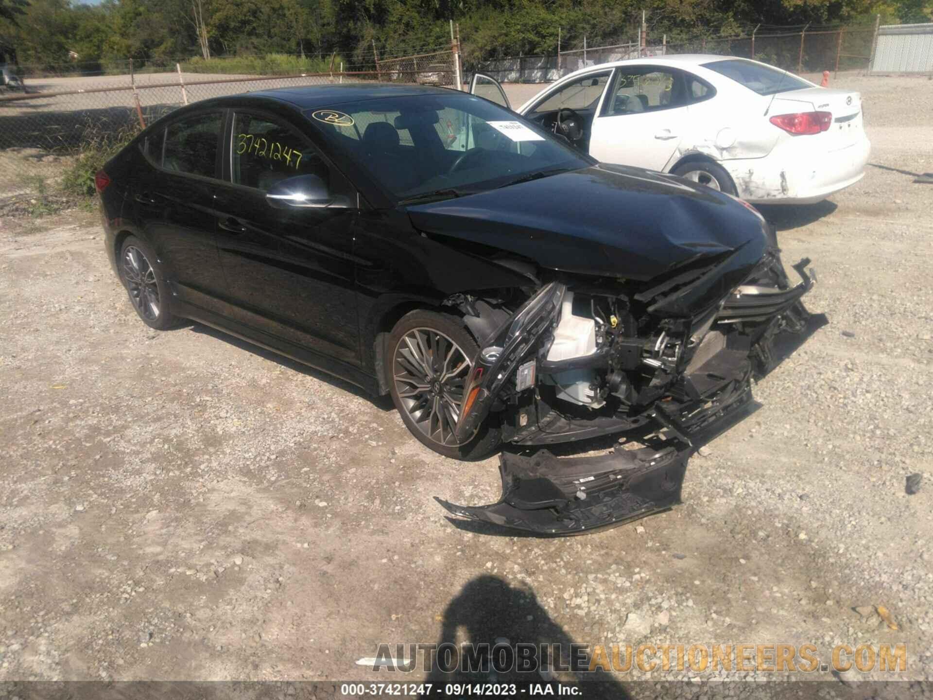 KMHD04LB2JU724302 HYUNDAI ELANTRA 2018