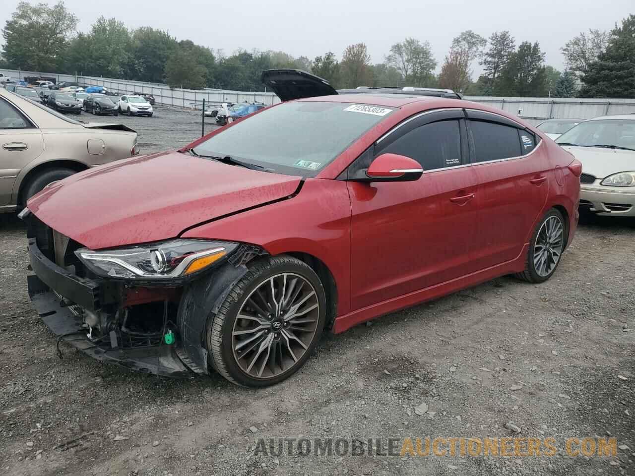 KMHD04LB5JU485036 HYUNDAI ELANTRA 2018