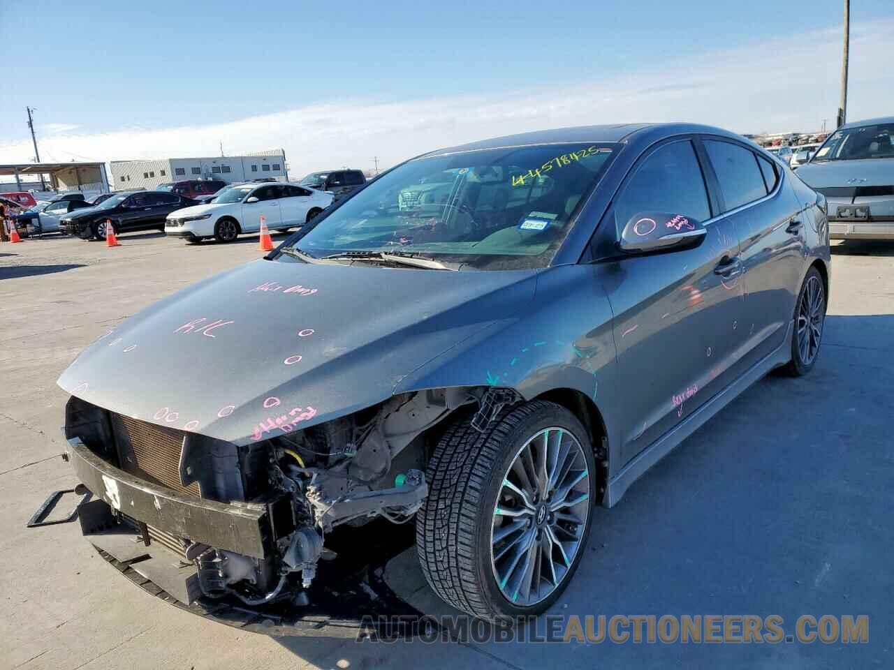 KMHD04LB6HU360329 HYUNDAI ELANTRA 2017