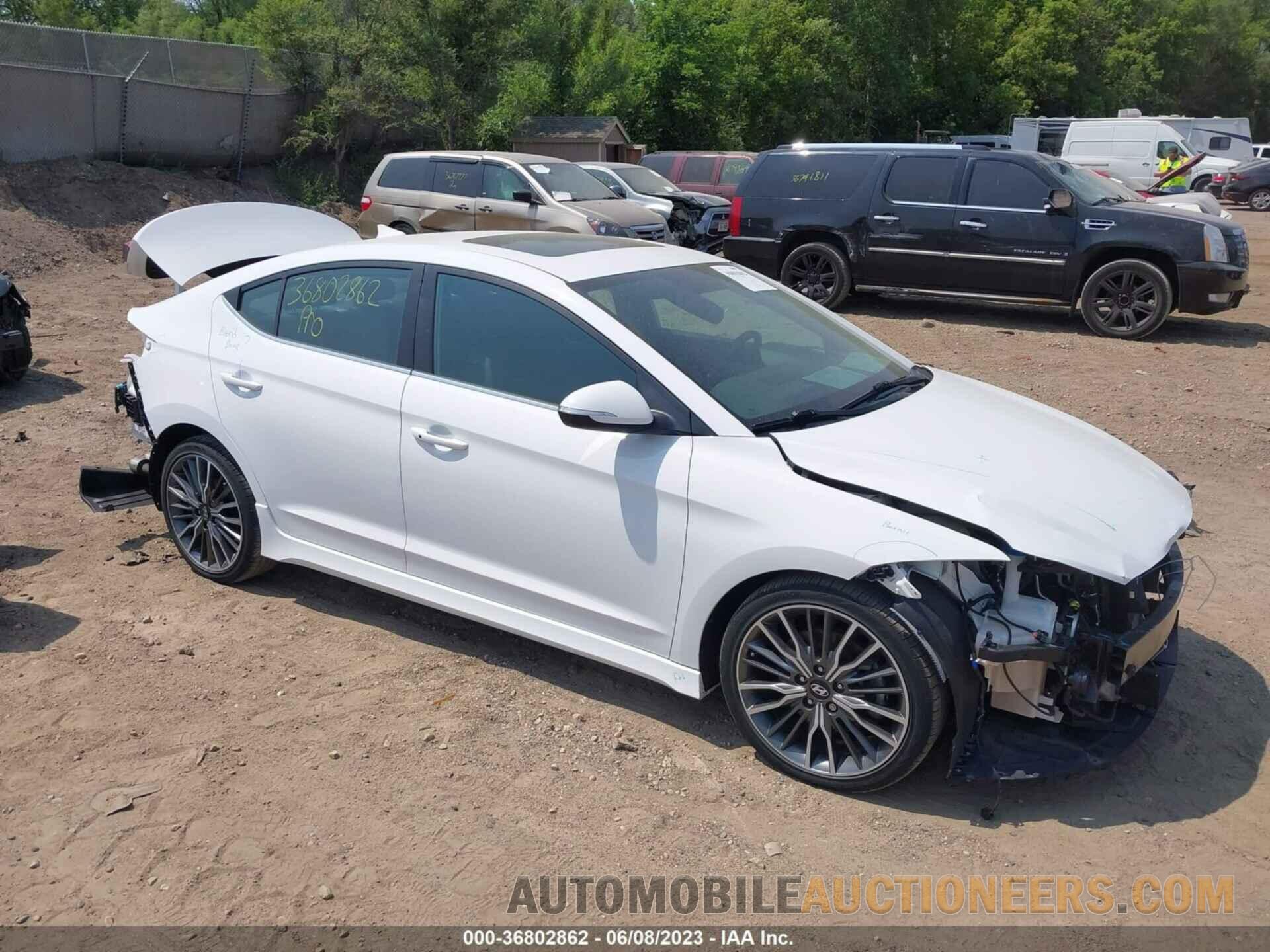 KMHD04LB7JU530851 HYUNDAI ELANTRA 2018