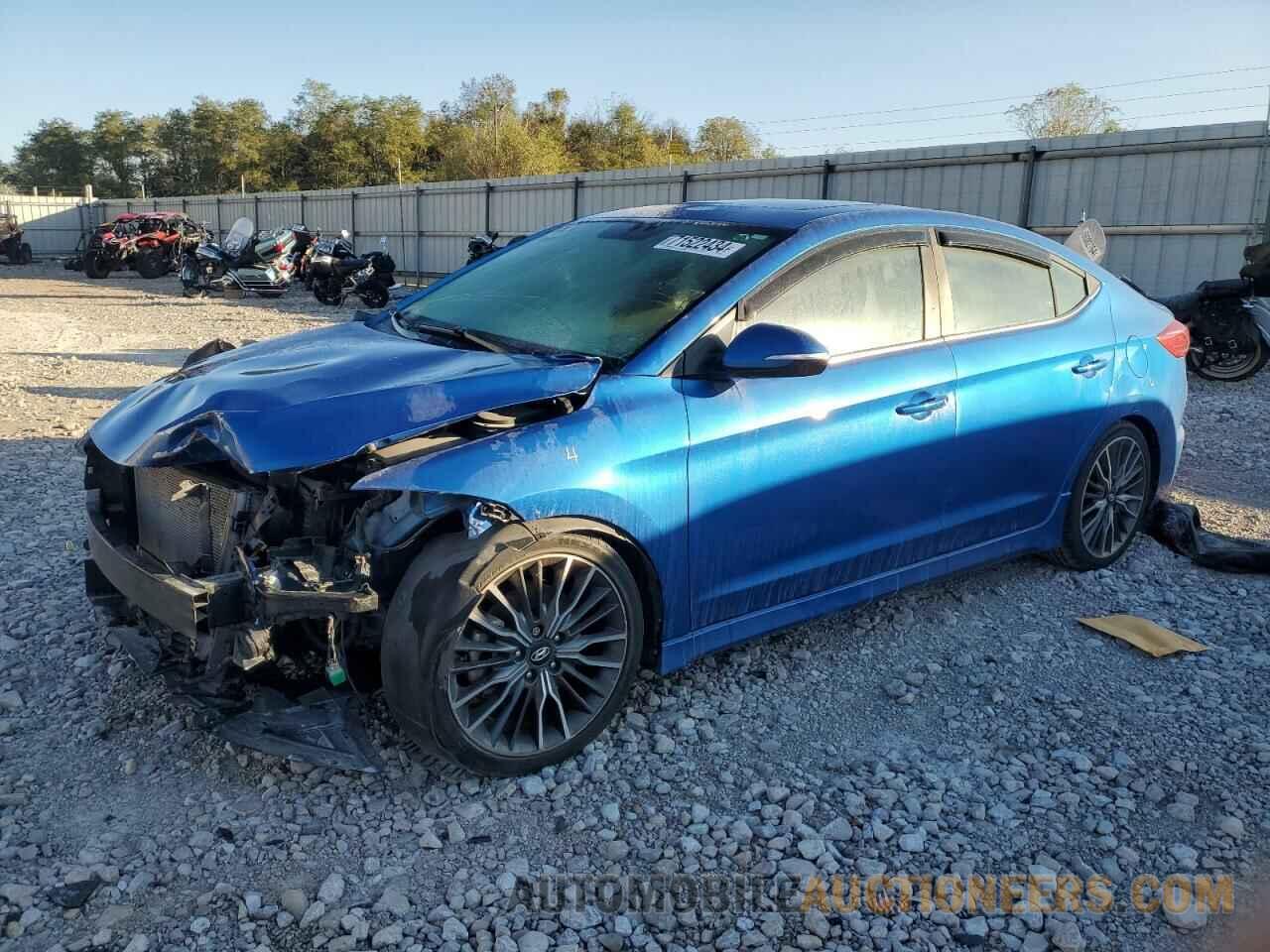 KMHD04LB9JU530320 HYUNDAI ELANTRA 2018