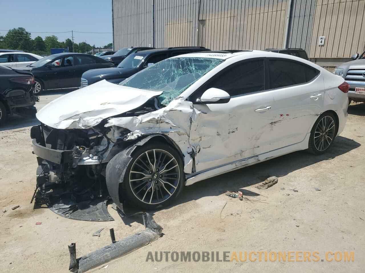 KMHD04LB9JU557307 HYUNDAI ELANTRA 2018