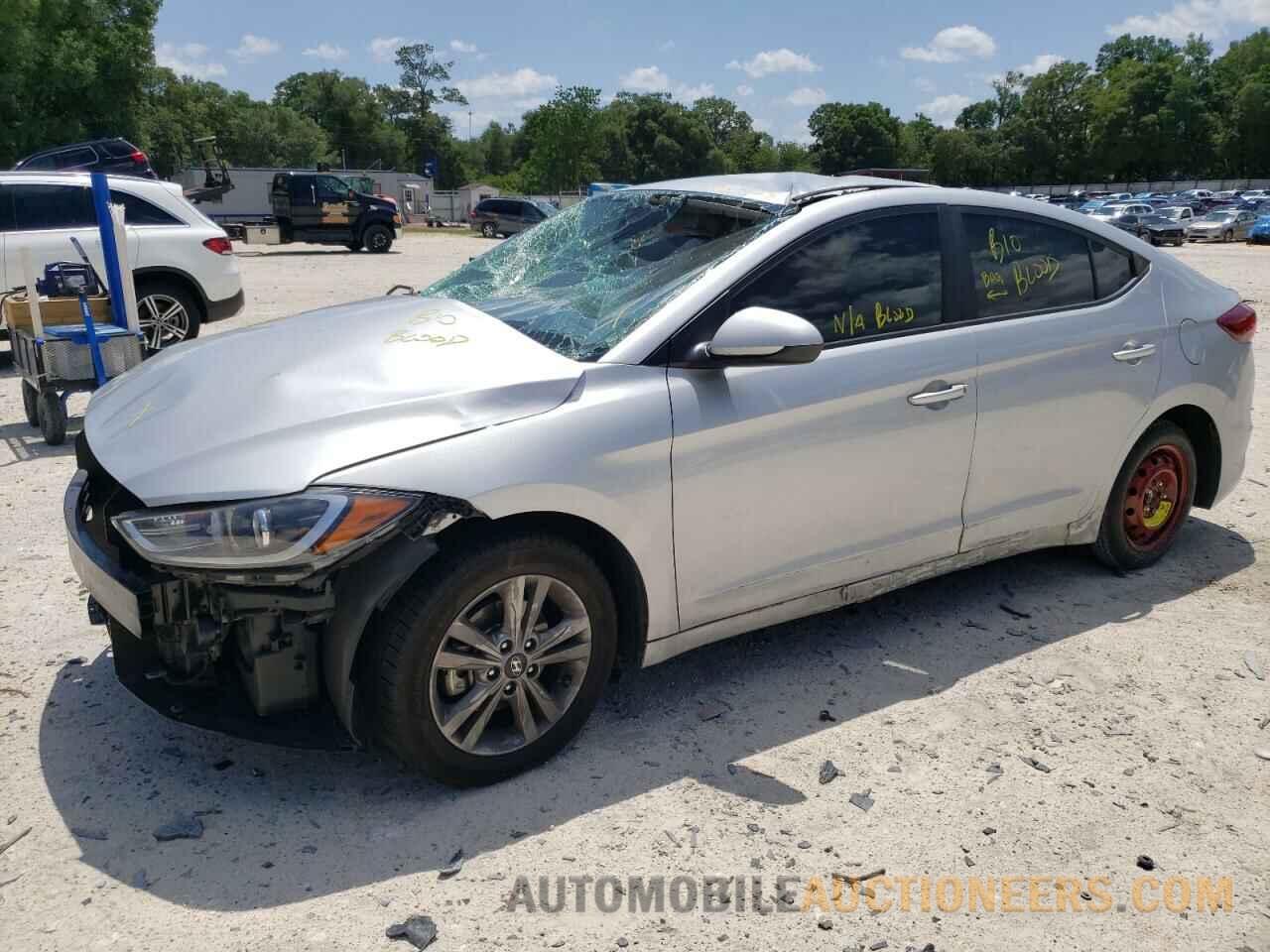 KMHD84LFXJU664927 HYUNDAI ELANTRA 2018